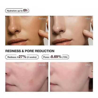 Radiance Serum
