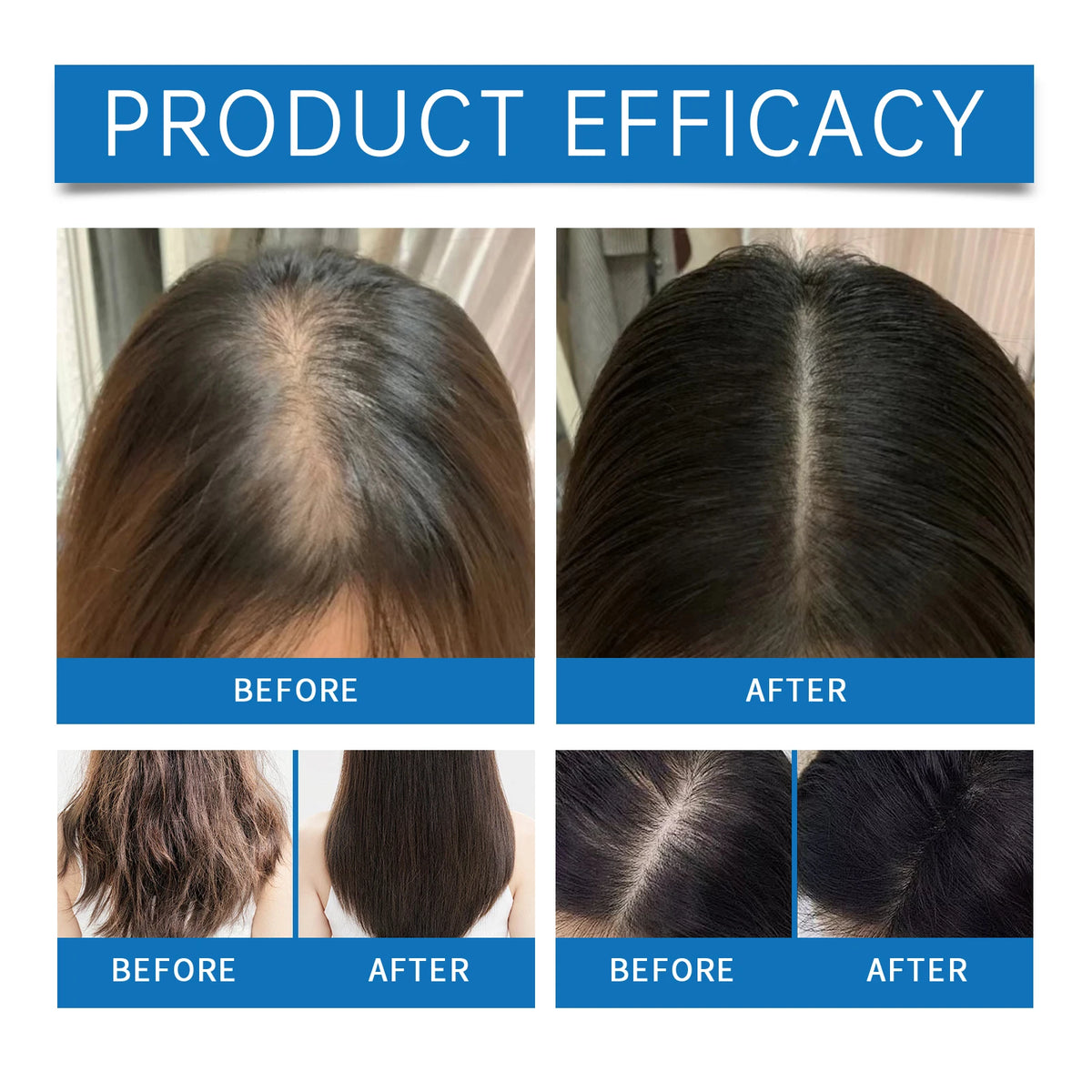 Hair Loss Treatment